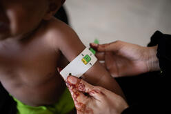 Der Arm eines Babys wird mit einem speziellen Maßband vermessen