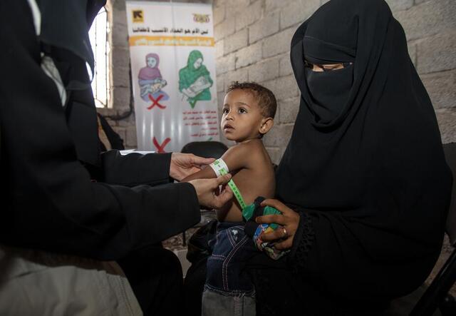 Ein Kind in Jemen wird auf Unterernährung untersucht.